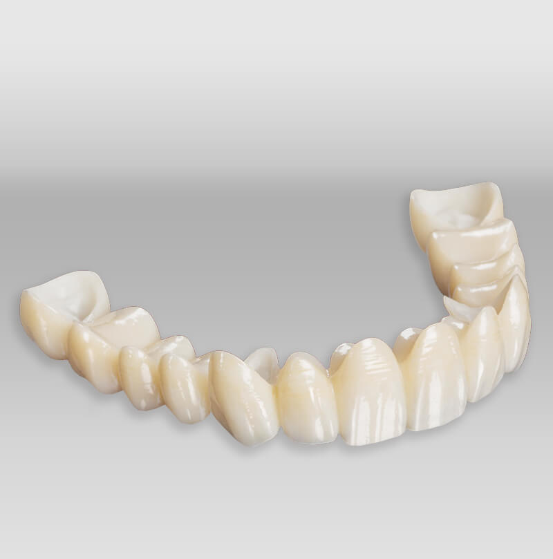 iTec Dental Laboratory - Irvine - Bruxzir Solid Zirconia