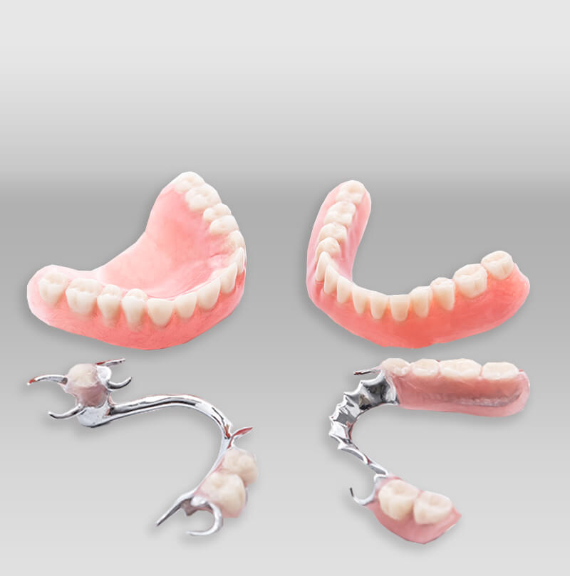 iTec Dental Laboratory - Irvine - Removable Partials & Dentures