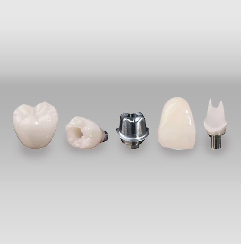 iTec Dental Laboratory - Irvine - Dental Implants