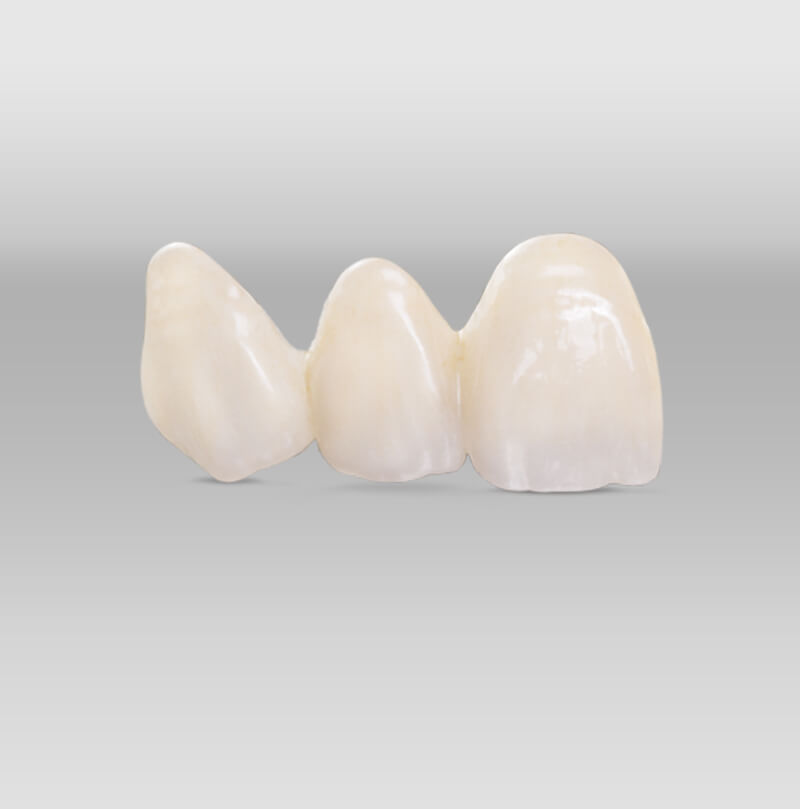 iTec Dental Laboratory - Irvine - Katana Zirconia